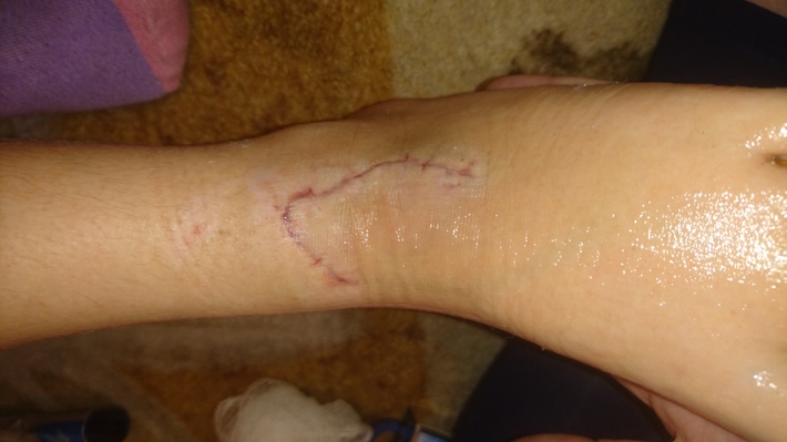 Przedziwny wypadek w publicznej toalecie! Zraniona... ZDJĘCIA