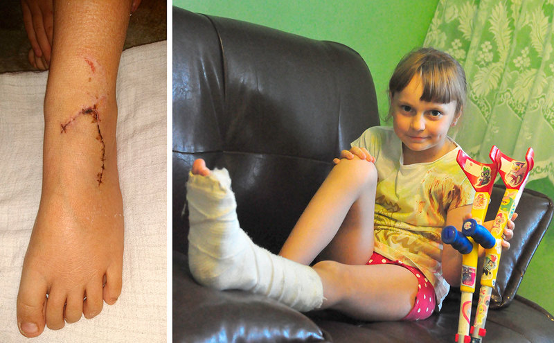 Przedziwny wypadek w publicznej toalecie! Zraniona... ZDJĘCIA