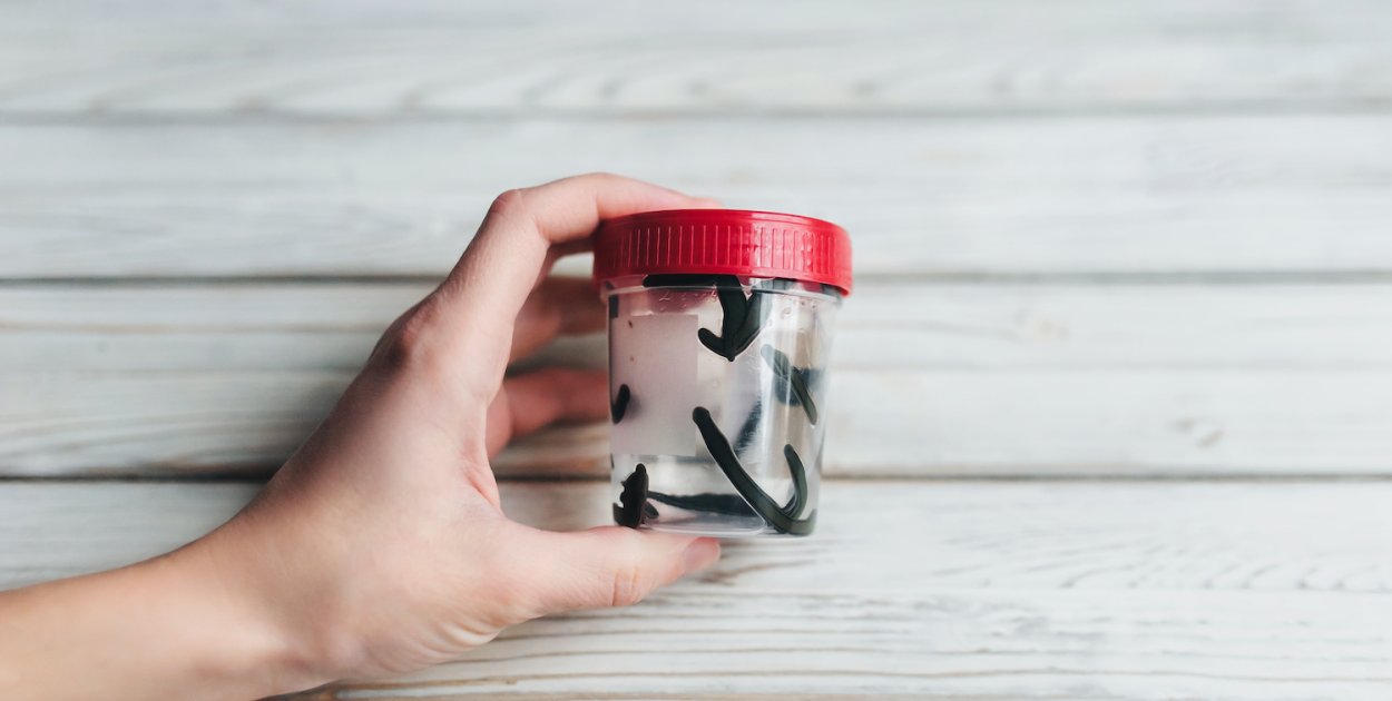 Hirudoterapia a zdrowie jelit – czy pijawki mogą wesprzeć leczenie dolegliwości je